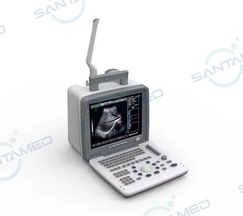 Portable Diagnostic Ultrasound Machine