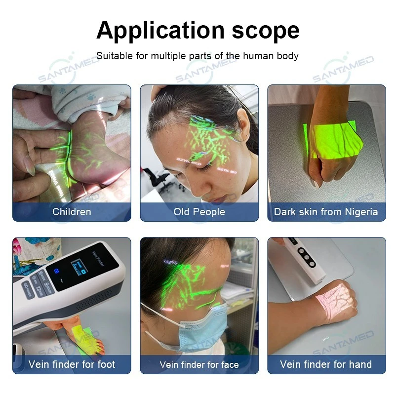 Near Infrared Vein Finder